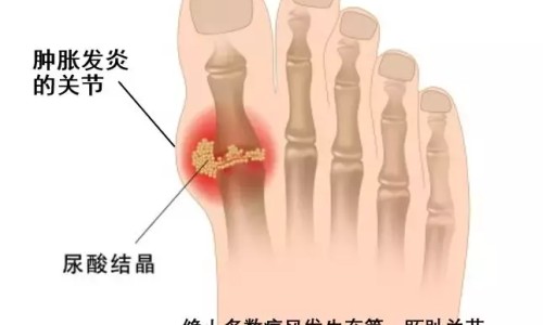 癌症病人爱睡觉是不是病情加重-癌症病人嗜睡怎么治疗网 :分享癌症患者乏力嗜睡是咋回事-癌症病人爱睡觉是不是病情加重知识